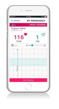 Miniland Detektor Tętna Płodu SweetBeat